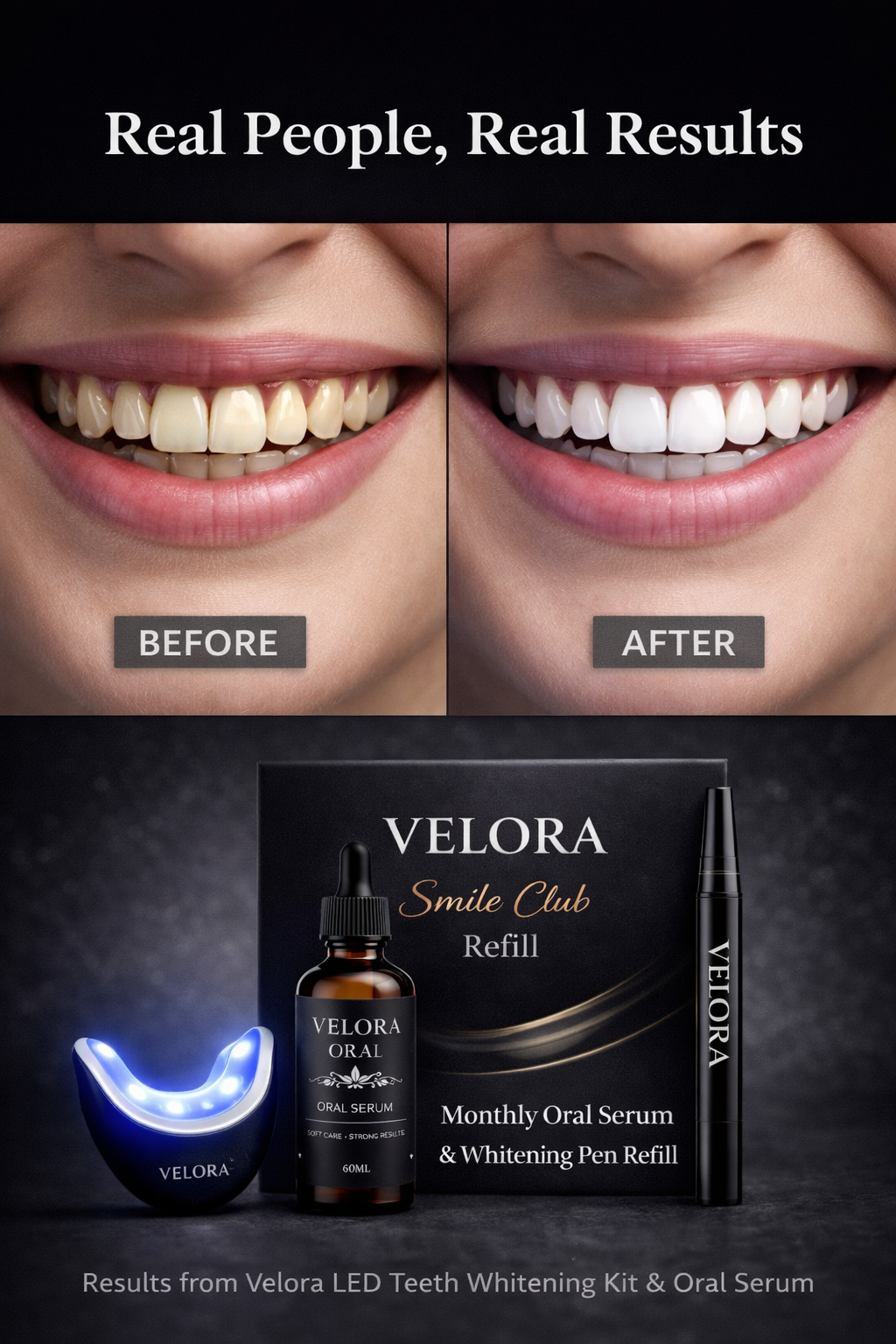 Velora Smile Club Refill